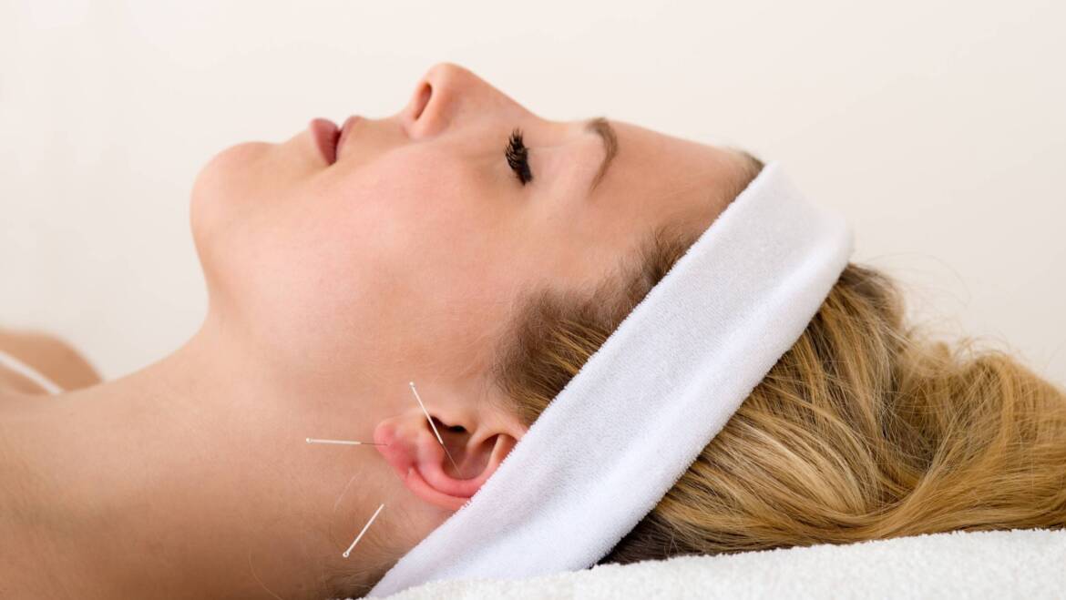 Øre akupunktur